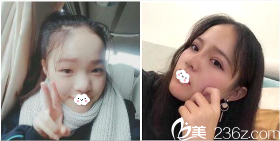 深圳微姿康壯為做的眼睛和鼻子<span style=