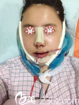 我剛做完手術 我剛做完手術