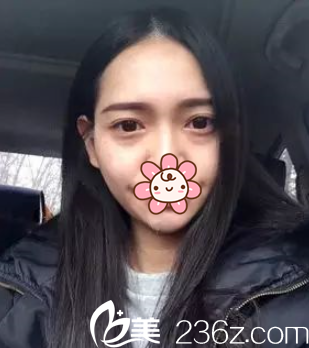 我去<!--<i data=20240703-sp></i>-->醫(yī)療美容之前的樣子 我去<!--<i data=20240703-sp></i>-->醫(yī)療美容之前的樣子