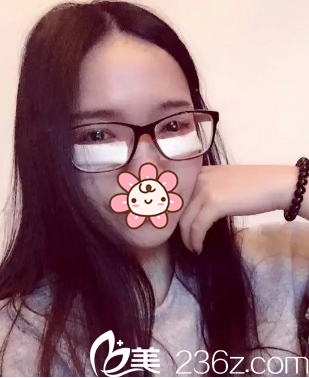 術后2天 術后2天