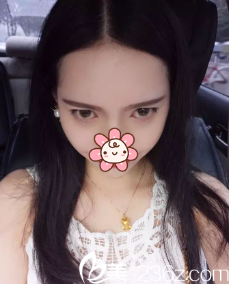 29天效果 29天效果