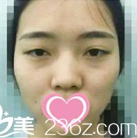 術(shù)前照片 術(shù)前照片