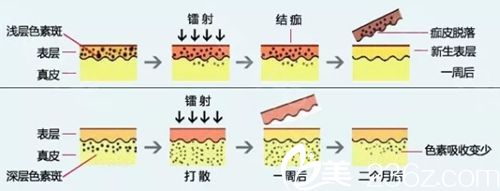 吉林哪家醫(yī)院做激光嫩膚好？吉林趙艷君白瓷娃娃1200元起幫你美膚
