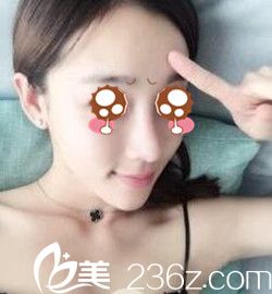 南陽(yáng)維多利亞隆鼻后半個(gè)月 南陽(yáng)維多利亞隆鼻后半個(gè)月