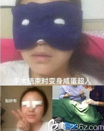 <!--<i data=20240703-sp></i>-->魏敬想做雙眼皮手術(shù)過程 <!--<i data=20240703-sp></i>-->魏敬想做雙眼皮手術(shù)過程