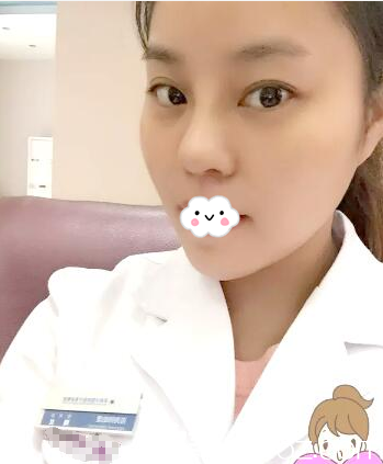 快看啊閨蜜小雪找江門(mén)華美整形美容醫(yī)院歐國(guó)升院長(zhǎng)做的隆鼻案例美翻了