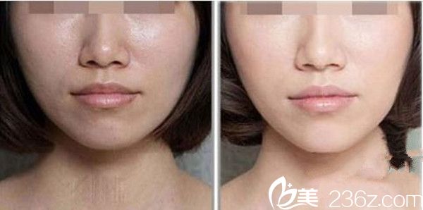 徐云泳皮膚美白案例 徐云泳皮膚美白案例