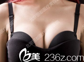 術(shù)后一個月照片 術(shù)后一個月照片