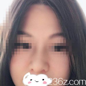 術后一周 術后一周