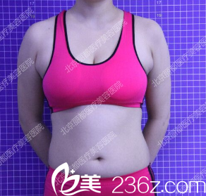 北京米蘭柏羽麗都醫(yī)療美容醫(yī)院案例術前照 北京米蘭柏羽麗都醫(yī)療美容醫(yī)院案例術前照