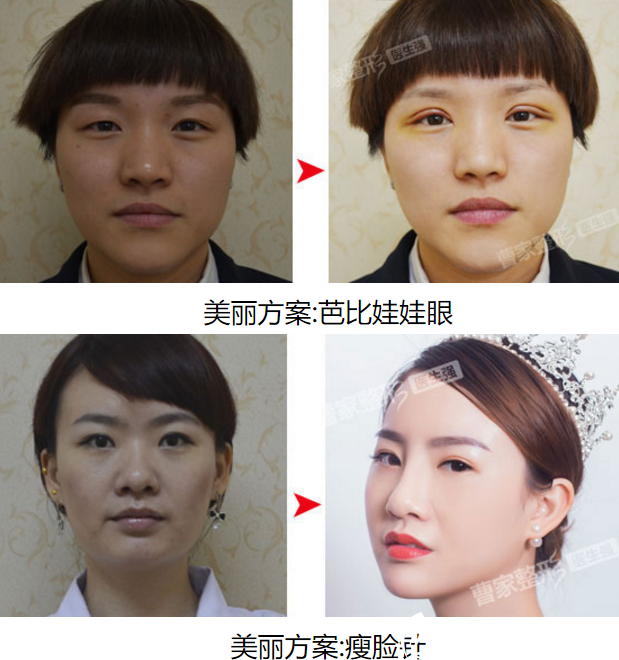 <!--<i data=20240703-sp></i>-->打造的案例 <!--<i data=20240703-sp></i>-->打造的案例