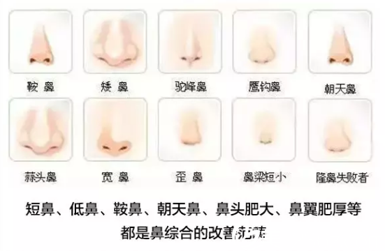 南寧隆鼻哪家醫(yī)院好？南寧陳炳俊鼻綜合手術(shù)19000元起塑美鼻