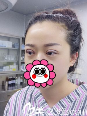 術(shù)后即刻效果 術(shù)后即刻效果