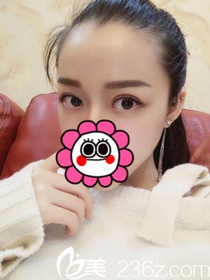 術(shù)后一個月效果 術(shù)后一個月效果