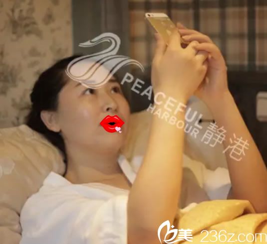 在靜港剛做完埋線手術(shù)效果圖