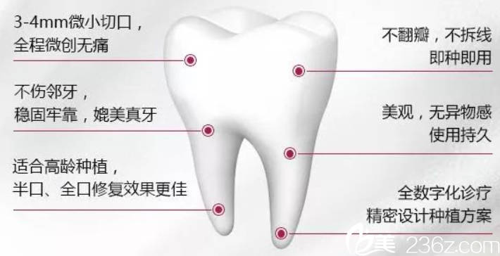 貴州利美康種植牙優(yōu)勢 貴州利美康種植牙優(yōu)勢