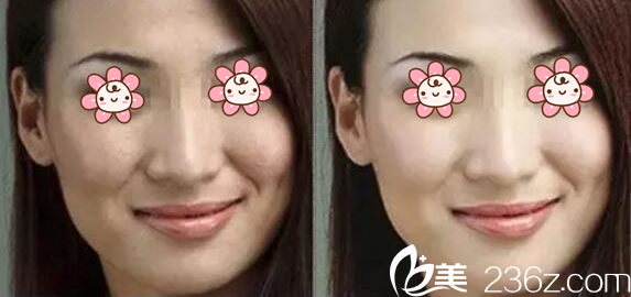 黃愛文主任案例 黃愛文主任案例