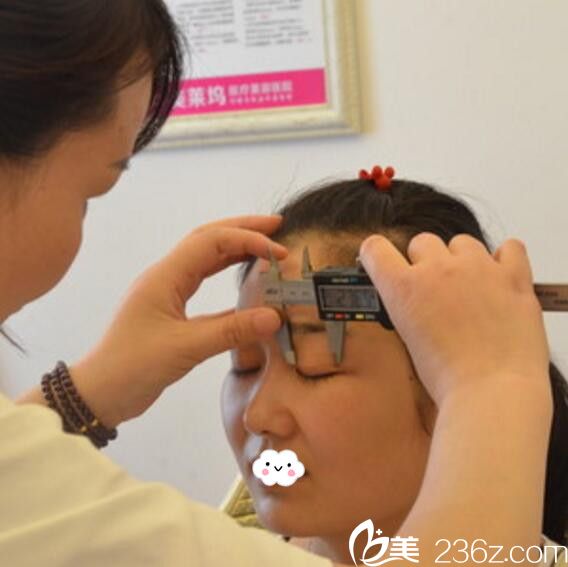 淮北微悅（伊爾美）醫(yī)療美容門診部雙眼皮術(shù)前測量