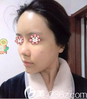 范眉清醫(yī)生給我做完第二天