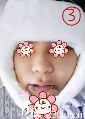 姬廣翰醫(yī)生給我手術(shù)后第3天 姬廣翰醫(yī)生給我手術(shù)后第3天