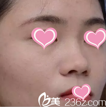 術(shù)前照片 術(shù)前照片