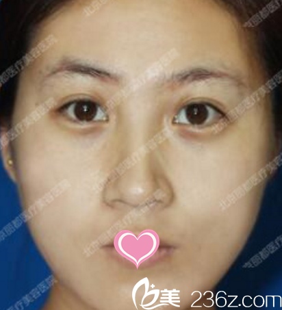 第十天的樣子 第十天的樣子