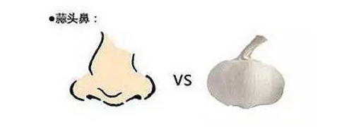 什么是蒜頭鼻 什么是蒜頭鼻