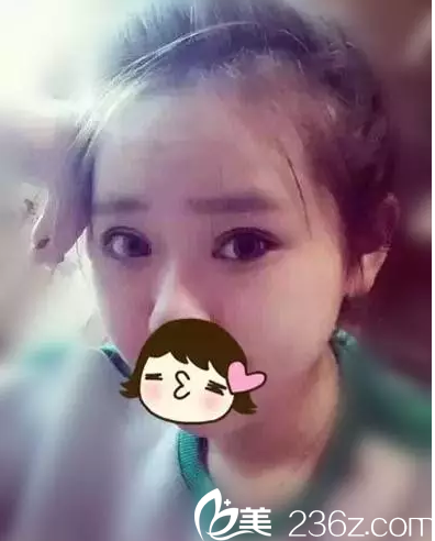 術(shù)后一周 術(shù)后一周