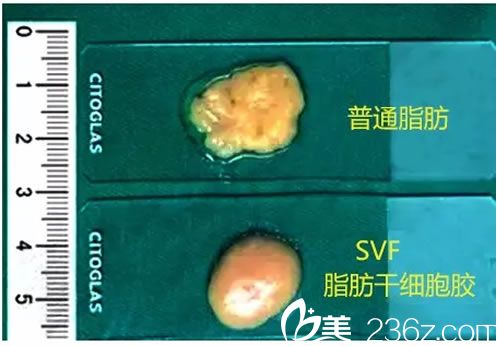 壹加壹SVF脂肪膠