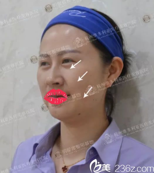 到維多利亞做線雕前側面照