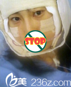 面部輪廓整形天照