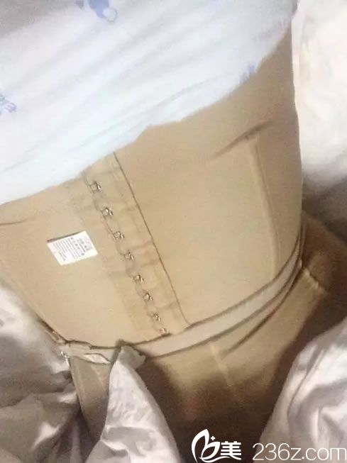 腰腹部吸脂后穿塑形衣的照片 腰腹部吸脂后穿塑形衣的照片