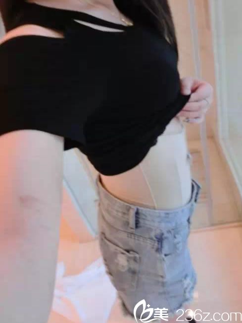 金華亞美腰腹吸脂<span style= 金華亞美腰腹吸脂<span style=