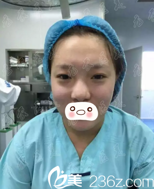 術(shù)前照片 術(shù)前照片