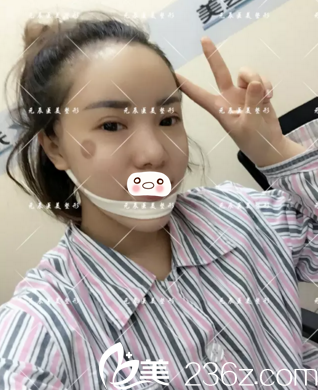 術(shù)后第二天情況 術(shù)后第二天情況