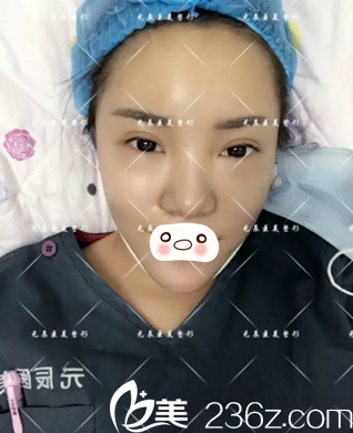 第三天情況 第三天情況