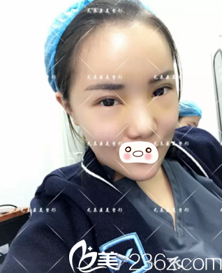 第五天恢復(fù)情況 第五天恢復(fù)情況