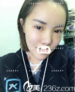 術(shù)后第六天情況 術(shù)后第六天情況