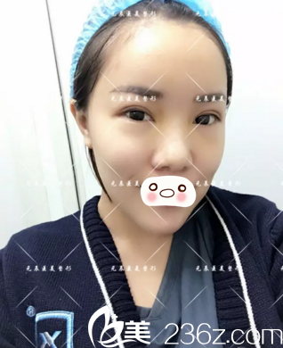 第十天的效果情況 第十天的效果情況