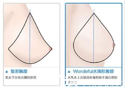 上饒韓美整形美容醫(yī)院胸部整形價(jià)格