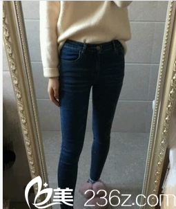 吸脂后一個月的照片