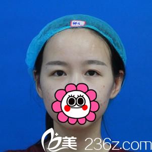 術(shù)前照 術(shù)前照