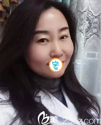 在悅美做了治療 術(shù)后即刻就發(fā)現(xiàn)面部提升效果明顯