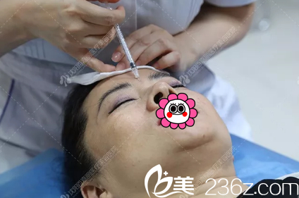 注射玻尿酸填充皺紋