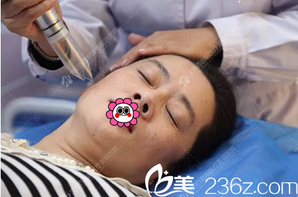 激光提升面部肌膚彈性