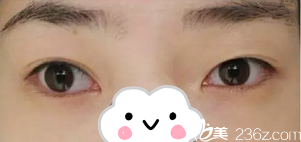 我手術(shù)之前的照片 我手術(shù)之前的照片