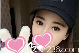 找包頭麗人陳秀芳割了個(gè)雙眼皮 二十天里我拍了N張圖片