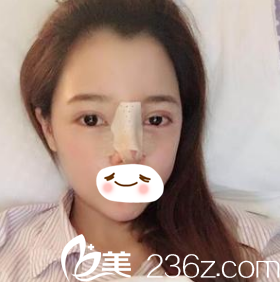 術(shù)后當(dāng)天照片