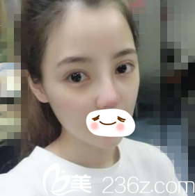 術(shù)后一周拆線