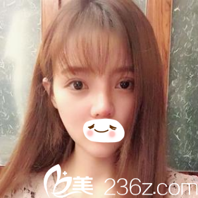 術(shù)后第十天效果